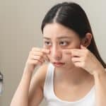 Menghilangkan kerutan di bawah mata secara efektif