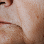 Menutupi noda coklat setelah usia 40 tahun