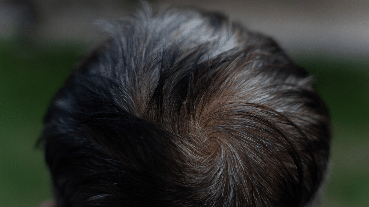 Rambut yang Beruban: Mengerti Perubahan Warna Rambut dan Penyebabnya